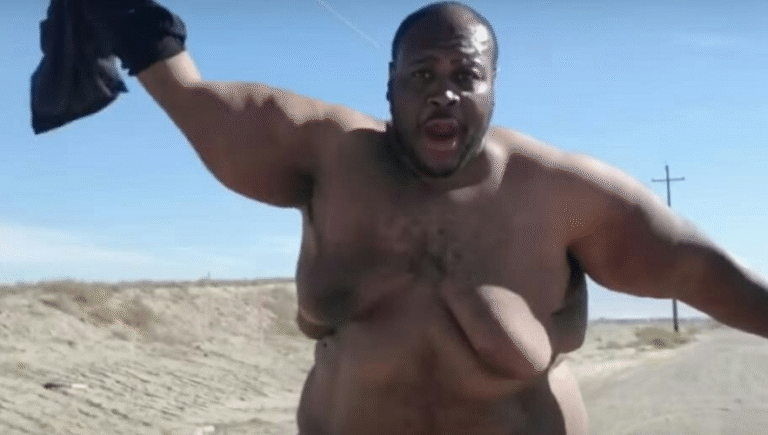EDP445 age